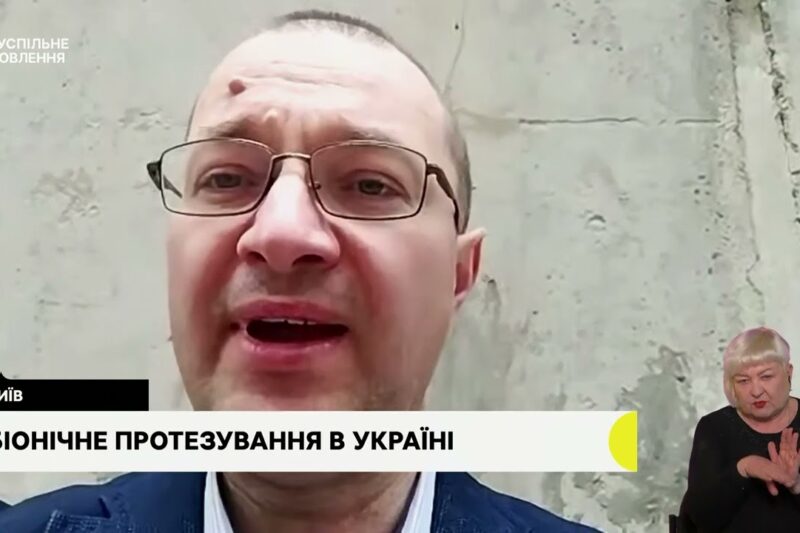 Біонічне протезування. Гостьова студія з Віталієм Музиченко, гендиректором Фонду.