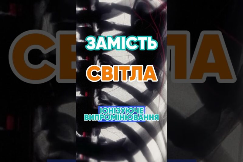 Чому рентген показує кістки? 🦴 #наука #цікаво #рентген #медицина