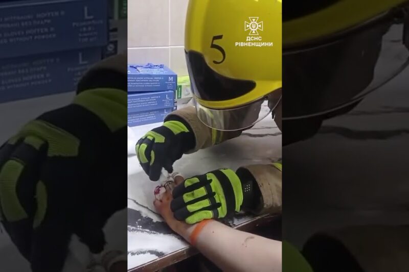 Хірургічна точність: на Рівненщині рятувальники вивільнити палець підлітка із металевої «пастки»