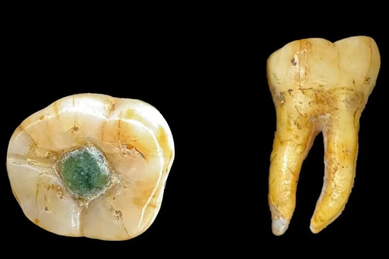 Давні мая використовували дорогоцінні камені як пломби