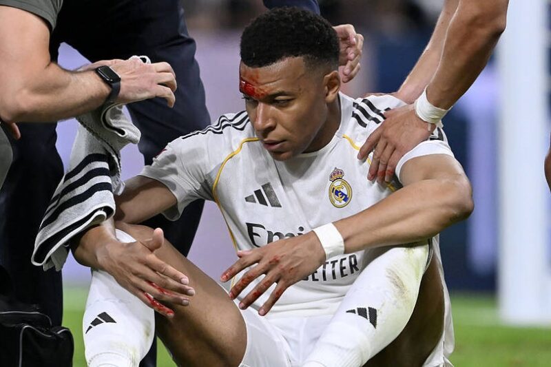 Розсічення не завада: Мбаппе очікують у матчі Ліги чемпіонів