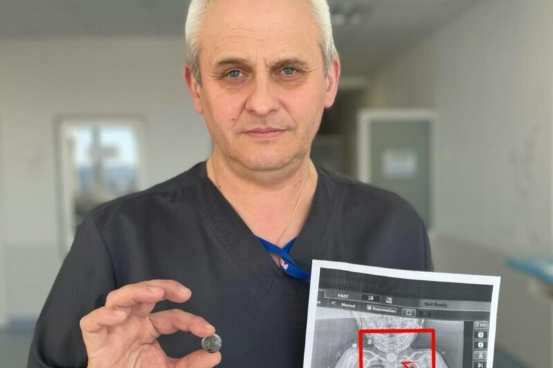 У Львові врятували дитину, яка місяцями жила з батарейкою у стравоході